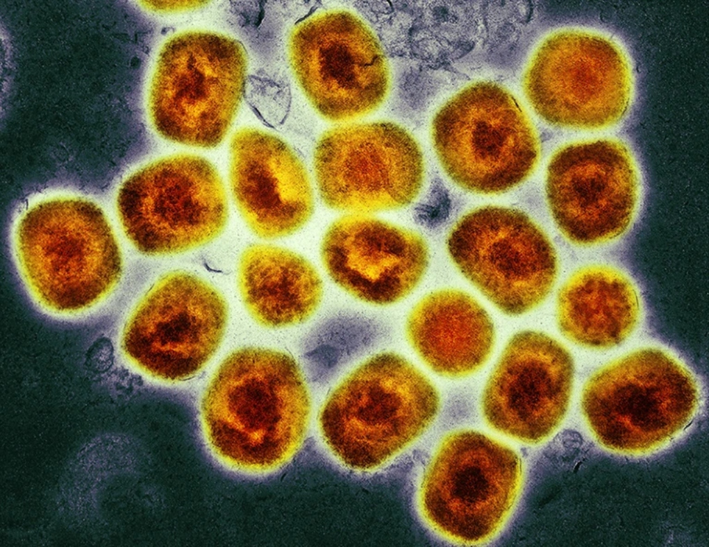 Ο ιός της ευλογιάς των πιθήκων μεταλλάσσεται- Τι λένε οι επιστήμονες